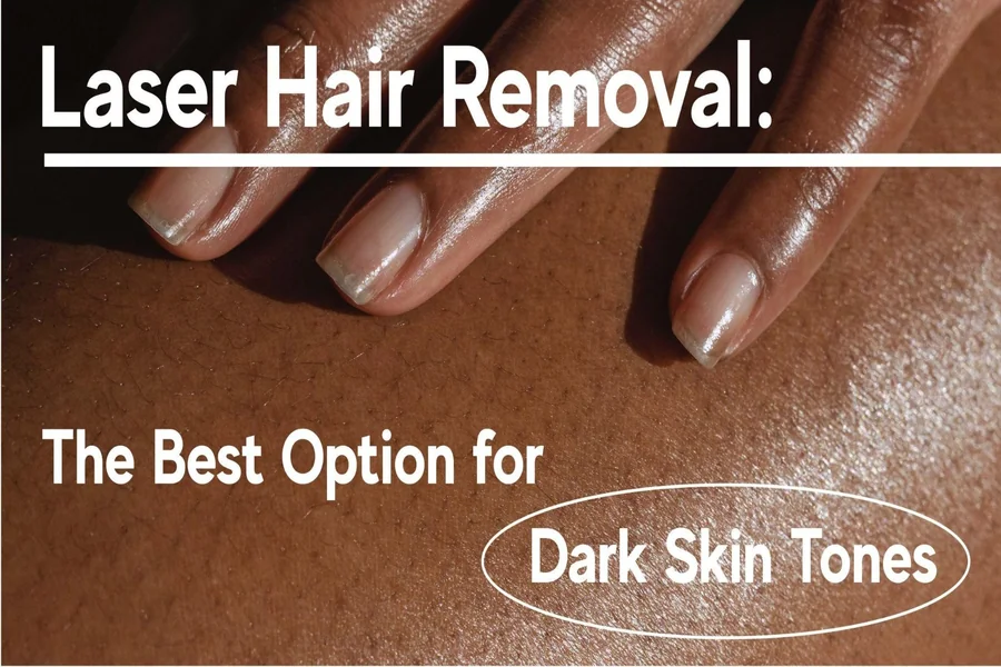 Laser Hair Removal For Dark Skin Things You Need To Know